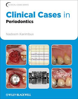 E-Book (pdf) Clinical Cases in Periodontics von 