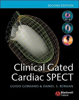 E-Book (pdf) Clinical Gated Cardiac SPECT von Guido Germano, Daniel S. Berman