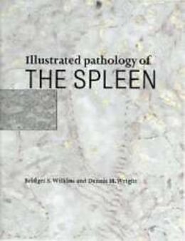 E-Book (pdf) Illustrated Pathology of the Spleen von Bridget S. Wilkins