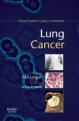 E-Book (pdf) Lung Cancer von Desai