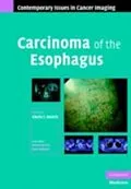 E-Book (pdf) Carcinoma of the Esophagus von Rankin