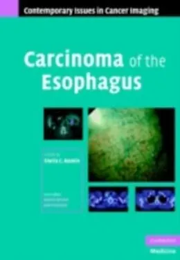 E-Book (pdf) Carcinoma of the Esophagus von Rankin
