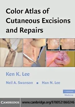 E-Book (pdf) Color Atlas of Cutaneous Excisions and Repairs von Ken K. Lee