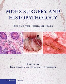 eBook (epub) Mohs Surgery and Histopathology de 