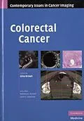 E-Book (pdf) Colorectal Cancer von Brown