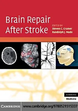 E-Book (pdf) Brain Repair After Stroke von Cramer/Nudo