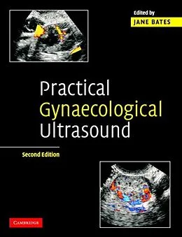 E-Book (pdf) Practical Gynaecological Ultrasound von Bates