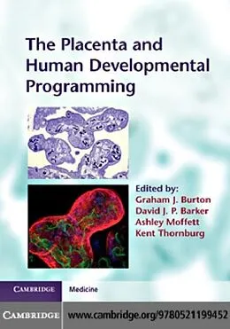 PDF Placenta and Human Developmental Programming von Burton