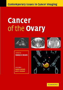 Fester Einband Cancer of the Ovary von Rodney Reznek