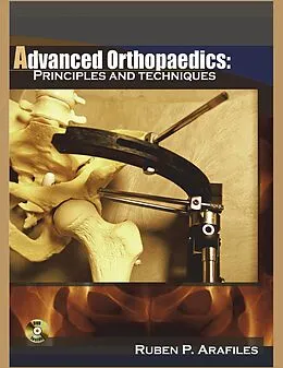 E-Book (epub) Advanced Orthopaedics von Md Ruben P. Arafiles