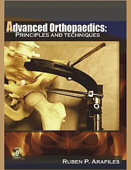 E-Book (pdf) Advanced Orthopaedics von Md Ruben P. Arafiles