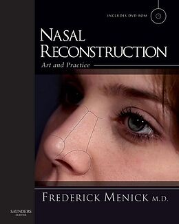 E-Book (pdf) Nasal Reconstruction: Art and Practice von Frederick J. Menick