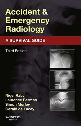 ePUB Accident and Emergency Radiology: A Survival Guide von Nigel Raby, Laurence Berman, Simon Morley