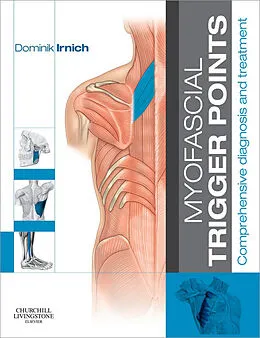 E-Book (epub) Myofascial Trigger Points von Dominik Irnich MD