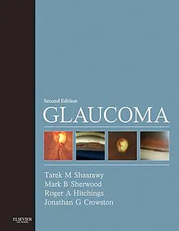 E-Book (epub) Glaucoma E-Book von MSc Shaarawy MD, FRCOphth Sherwood FRCP, Roger A. Hitchings FRCOphth