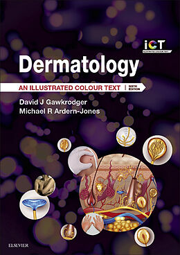 E-Book (epub) Dermatology E-Book von David Gawkrodger, Michael R Ardern-Jones