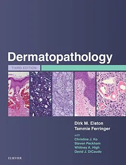 E-Book (epub) Dermatopathology von Dirk M. Elston, Tammie Ferringer, Christine Ko