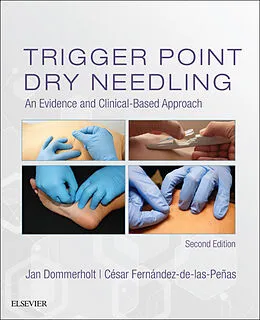 E-Book (epub) Trigger Point Dry Needling E-Book von Jan Dommerholt, Cesar Fernandez de las Penas