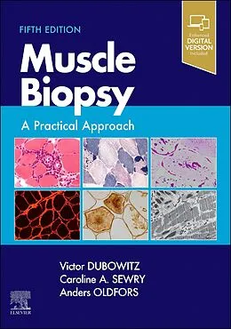E-Book (pdf) Muscle Biopsy E-Book von Dubowitz MD, Sewry BSc, Anders Oldfors MD