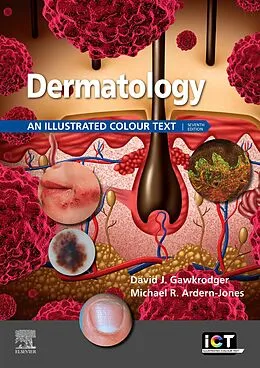 E-Book (epub) Dermatology E-Book von David Gawkrodger, Michael R. Ardern-Jones