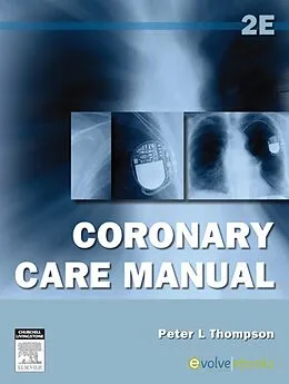 E-Book (epub) Coronary Care Manual von Fracp Thompson MD