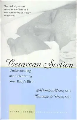 E-Book (epub) Cesarean Section von Michele C. Moore