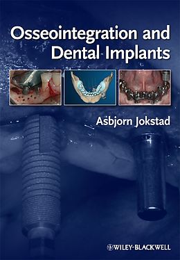 eBook (pdf) Osseointegration and Dental Implants de 