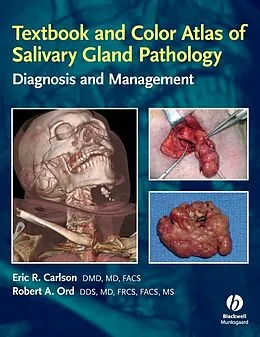 E-Book (pdf) Textbook and Color Atlas of Salivary Gland Pathology von Eric Carlson, Robert Ord