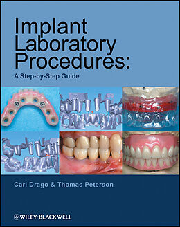 eBook (pdf) Implant Laboratory Procedures de Carl Drago, Thomas Peterson