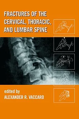 PDF Fractures of the Cervical, Thoracic, and Lumbar Spine von Alexander R. Vaccaro