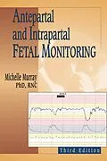 E-Book (epub) Antepartal and Intrapartal Fetal Monitoring von Michelle Murray