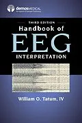 E-Book (epub) Handbook of EEG Interpretation, Third Edition von William O. Tatum