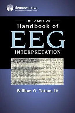 E-Book (epub) Handbook of EEG Interpretation, Third Edition von William O. Tatum