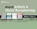 E-Book (epub) Atlas of Artifacts in Clinical Neurophysiology von William O. Tatum