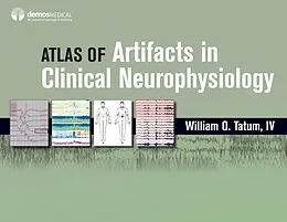 E-Book (epub) Atlas of Artifacts in Clinical Neurophysiology von William O. Tatum
