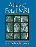 E-Book (pdf) Atlas of Fetal MRI von Deborah Levine