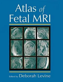 E-Book (pdf) Atlas of Fetal MRI von Deborah Levine
