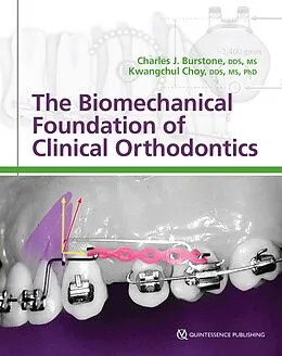 E-Book (epub) The Biomechanical Foundation of Clinical Orthodontics von Charles J. Burstone, Kwangchul Choy
