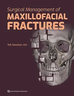 E-Book (pdf) Surgical Management of Maxillofacial Fractures von Yoh Sawatari