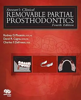 E-Book (pdf) Stewart's Clinical Removable Partial Prosthodontics von Rodney D. Phoenix, David R. Cagna, Charles F. DeFreest