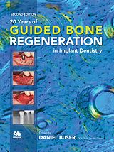 E-Book (pdf) 20 Years of Guided Bone Regeneration in Implant Dentistry von Daniel Buser