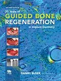 E-Book (pdf) 20 Years of Guided Bone Regeneration in Implant Dentistry von Daniel Buser