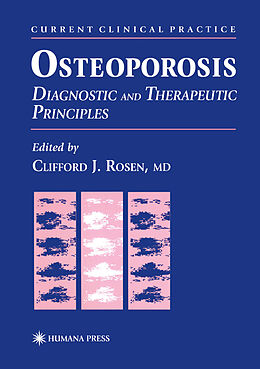 Fester Einband Osteoporosis von 