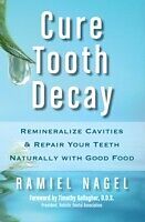 E-Book (epub) Cure Tooth Decay: Remineralize Cavities and Repair Your Teeth Naturally with Good Food [Second Edition] von Ramiel Nagel
