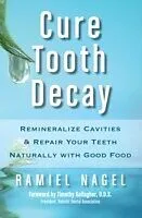 eBook (epub) Cure Tooth Decay: Remineralize Cavities and Repair Your Teeth Naturally with Good Food [Second Edition] de Ramiel Nagel