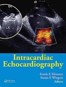 E-Book (epub) Intracardiac Echocardiography von Frank E. Silvestry, Susan E. Wiegers
