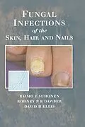 E-Book (epub) Fungal Infections of the Skin and Nails von Raimo E. Suhonen, Rodney P. R. Dawber, David H. Ellis