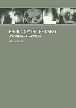 E-Book (epub) Radiology of the Chest and Related Conditions von F W Wright