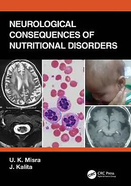 E-Book (epub) Neurological Consequences of Nutritional Disorders von U. K. Misra, J. Kalita