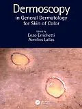 E-Book (epub) Dermoscopy in General Dermatology for Skin of Color von 